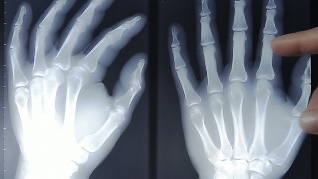 hand x-ray