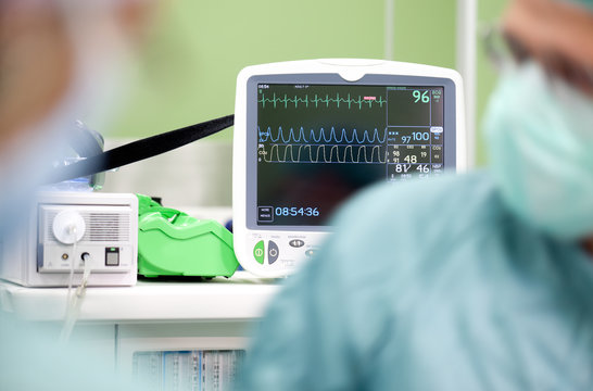 Cardiogram monitor ekg operation