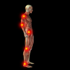 High resolution conceptual 3D human with inflammation