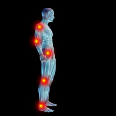 High resolution conceptual 3D human with inflammation