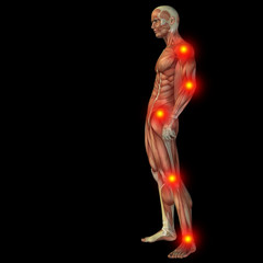 High resolution conceptual 3D human with inflammation