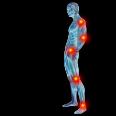 High resolution conceptual 3D human with inflammation