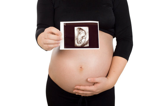Young pregnant woman holding photo of an ultrasound 