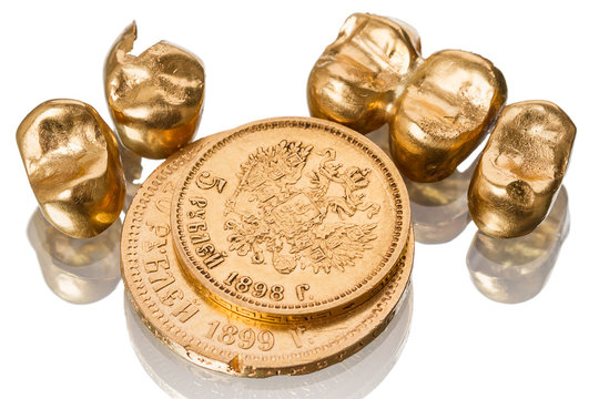 Gold dental crowns and  old coin