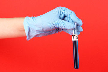 Test tube labeled Tuberculosis(TB) in hand on red background