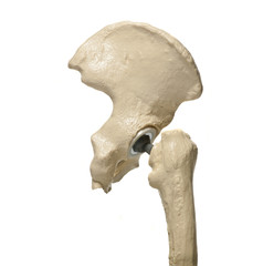 anatomic study model of an human hip replacement