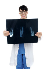 Doctor displaying x-ray report of thumb finger