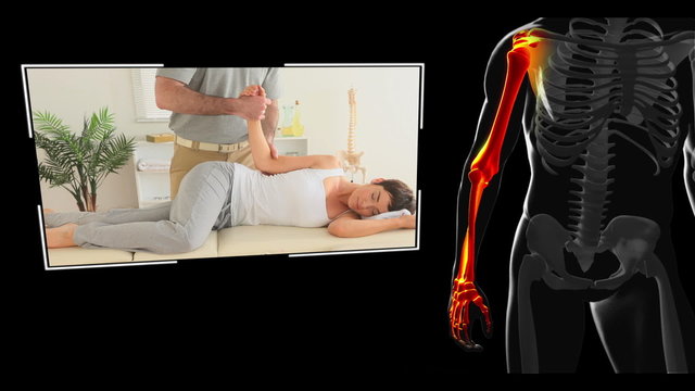 Clips of woman getting physiotherapy