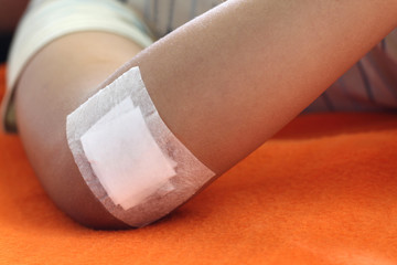 Wound sealed with plaster