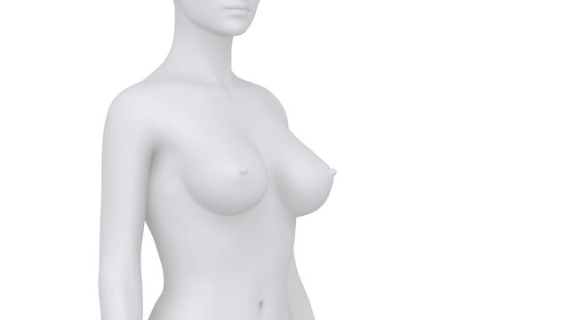 Female breast augmentation lateral vie with mask