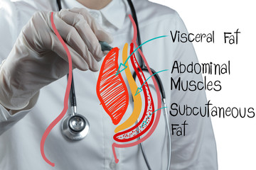 doctor draws abdominal fat