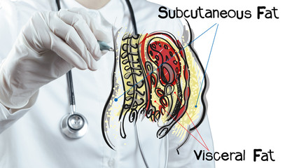 doctor draws abdominal fat