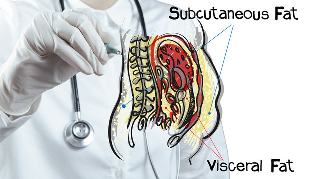 Doctor Draws Abdominal Fat