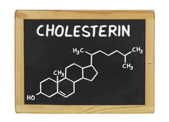 chemische Strukturformel von Cholesterin auf einer Schiefertafel