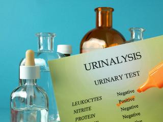 Urine analysis