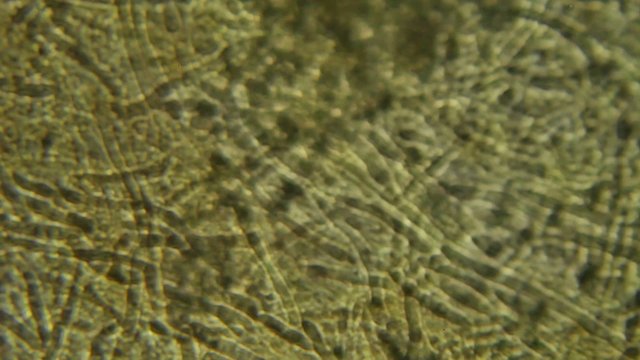 mushroom under the microscope, background. (Suillus) 