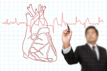 businessman drawing  the chart  heartbeat line, Medical concept