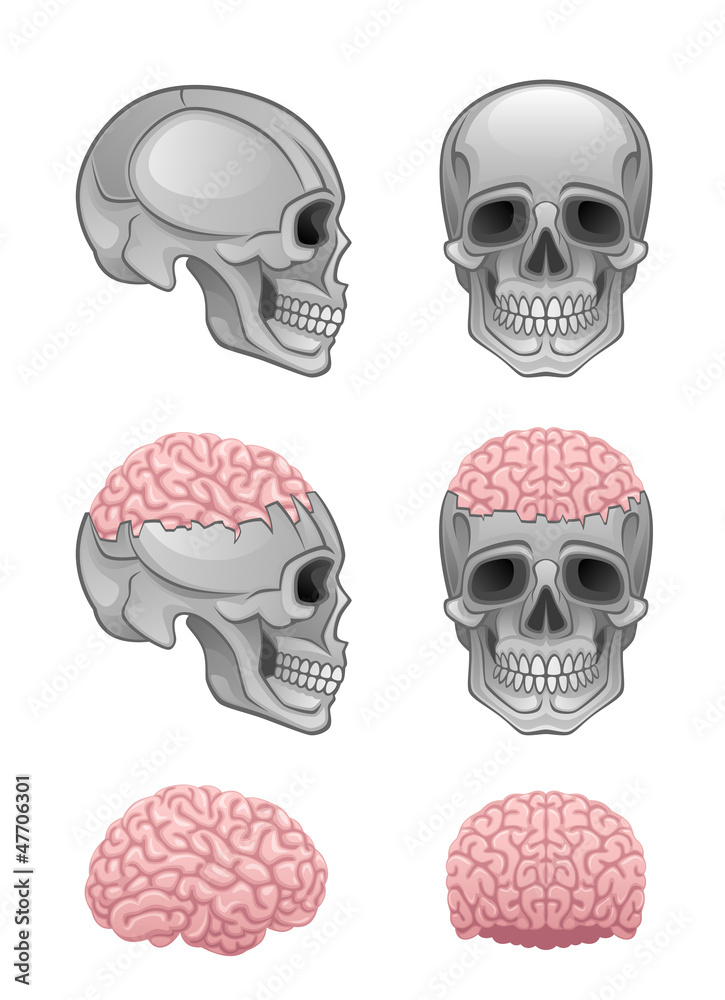 Sticker brain in skull