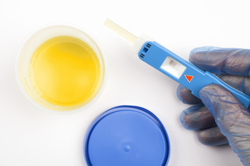 Urinprobe