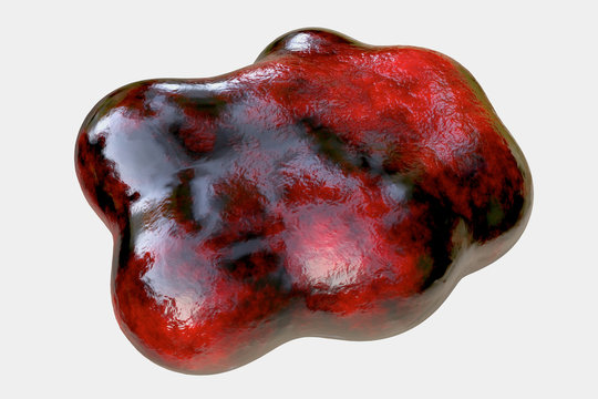 MRSA - ORSA 3D render