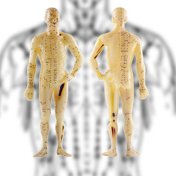 acupuncture chinoise