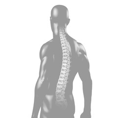 Rücken mit dem Röntgenbild der Wirbelsäule