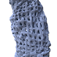 Osteoporose - 3D render isoliert