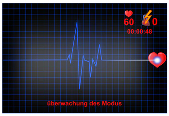 EKG