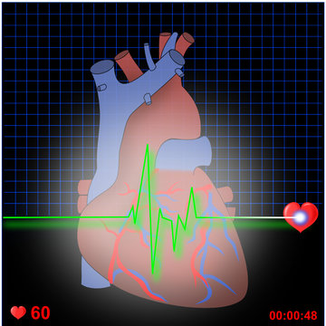 Herz EKG