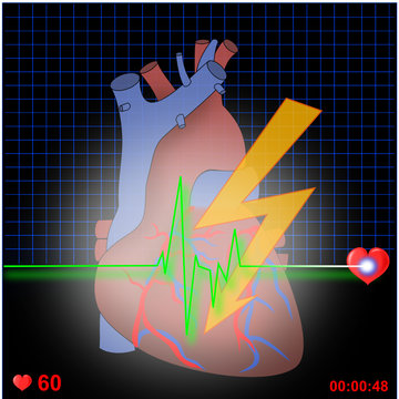 Herz EKG mit Blitz
