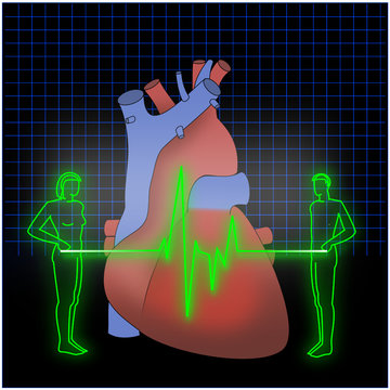 EKG Untersuchung