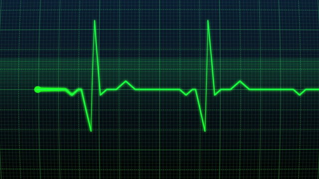heart rate