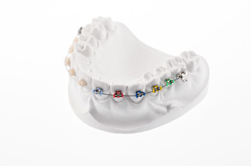 Dental lower jaw