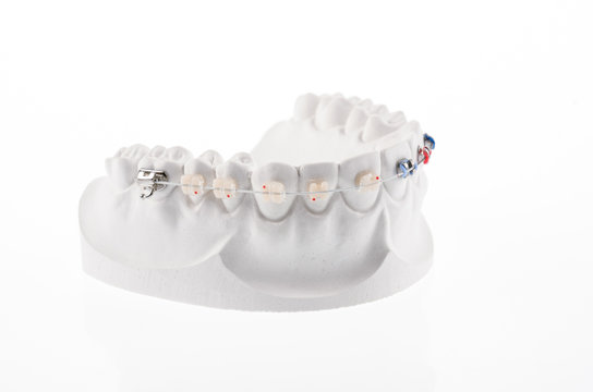 Dental lower jaw