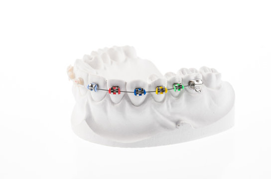 Dental lower jaw
