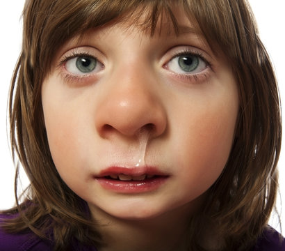 runny nose  - cold - ill little girl - funny concept