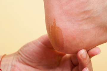Naklejka premium Pedicure procedure
