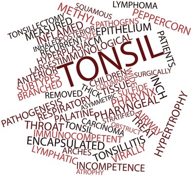 Word cloud for Tonsil
