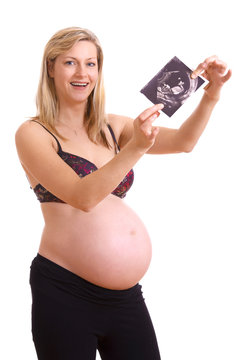 fröhliche Schwangere mit Ultraschallbild in den Händen