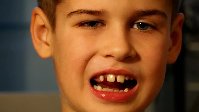 Cute boy showing loose tooth