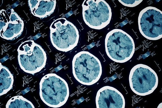 CT scan texture.Human scull