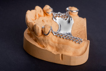 dental wax model