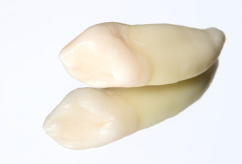 Extracted tooth
