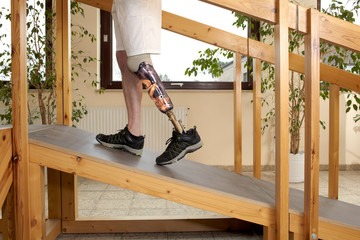 Male prosthesis wearer training to climb a slope