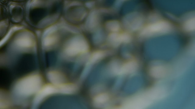 bubbles under a microscope
