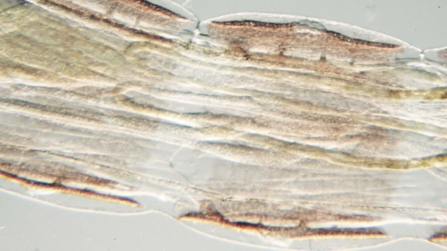 real life micro organism footage under a microscope