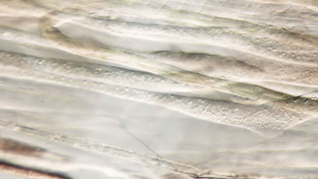 real life micro organism footage under a microscope