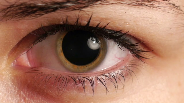 womans dilated pupil