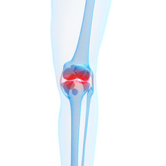 3d rendered illustration of a painful knee