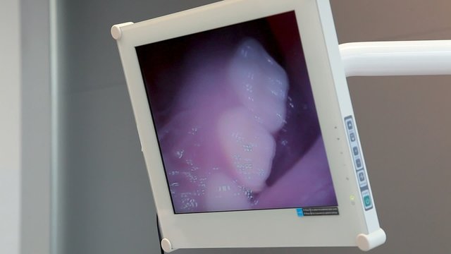 Woman dentist showing patient teeth on monitor